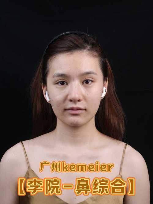 常州曙光医疗美容医院周建国鼻综合可信吗？听听做过的人怎么说，给你真实答案！ 