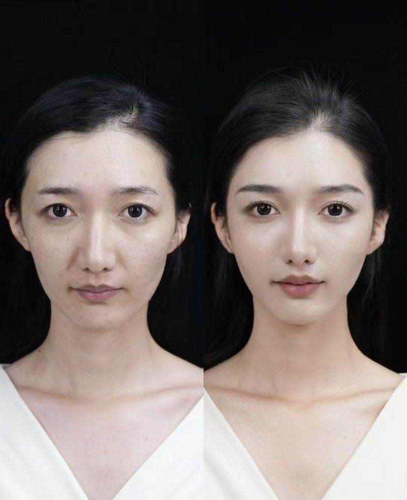 常州曙光医疗美容医院的多元项目与术后成效