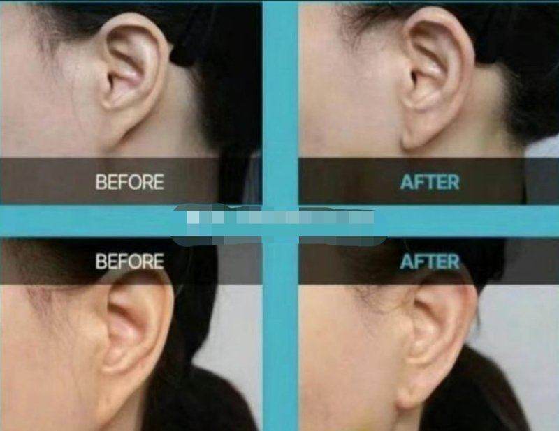 广州缪思医疗美容门诊部：允许“不理想”的美