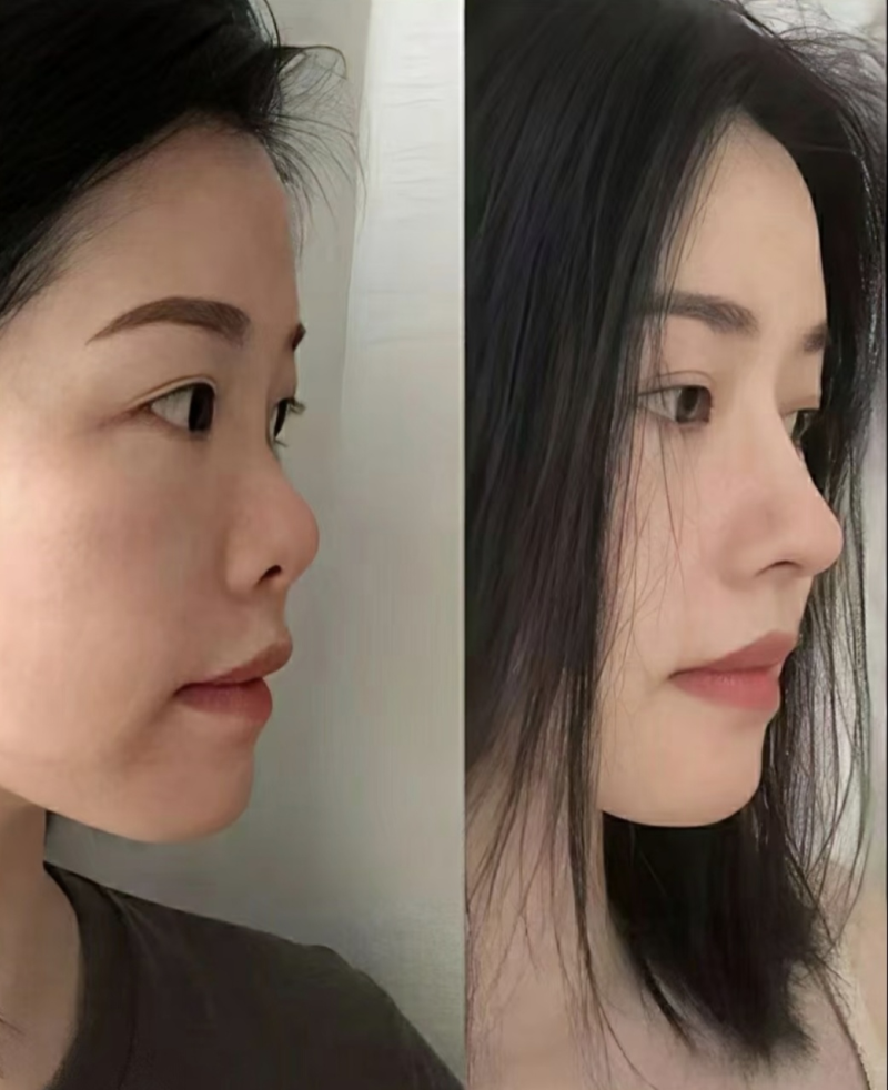 北京医院鲍世威医生的专精见解