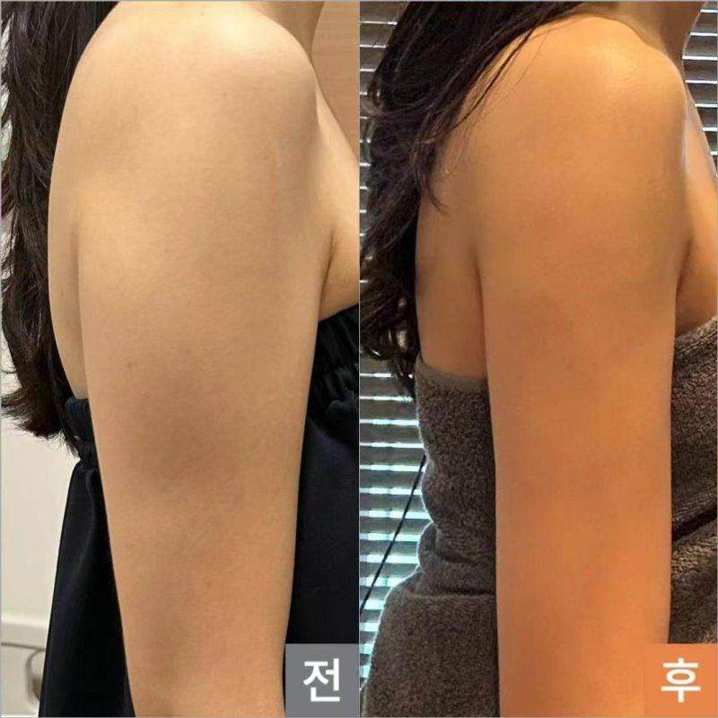 广州缪思医疗美容门诊部：尊重个性，追求自然美