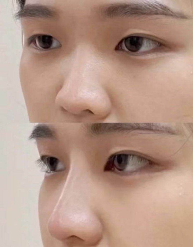 北京大学第三医院整形外科：综合实力强劲