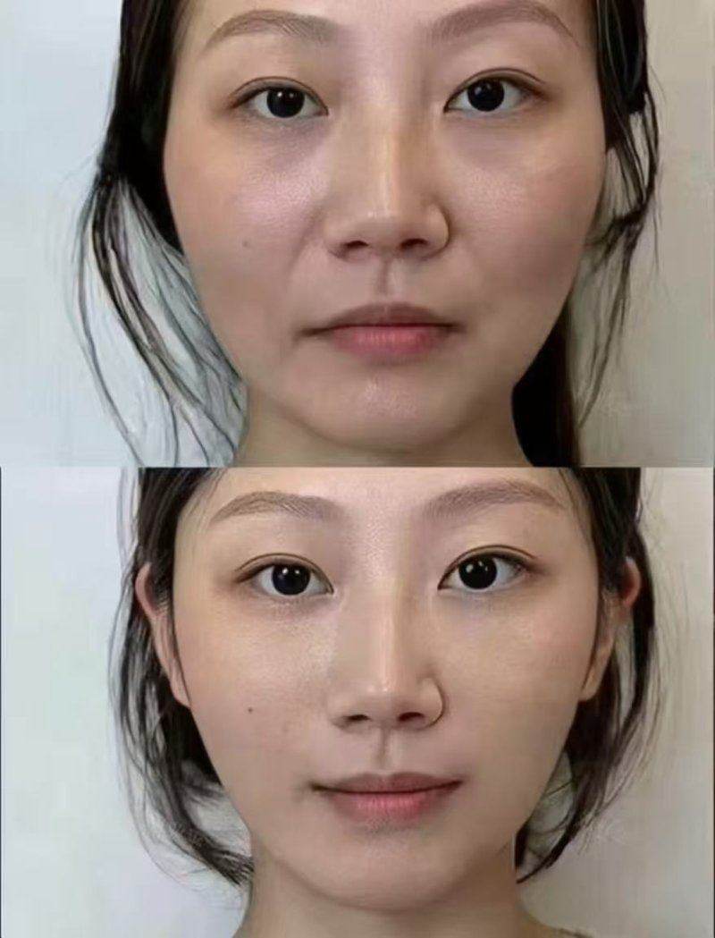 在线询问了解更多