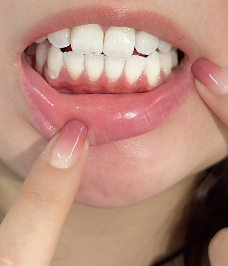 临沂壹颗芽口腔医院值得信赖吗？正规资质、专业医生，看牙体验好值得选 