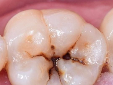 選擇晉中牙博士口腔診所的理由