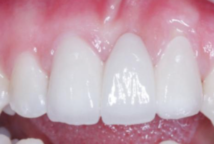 临沂壹颗芽口腔医院:特色项目突出,技术领跑