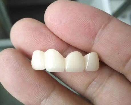 廣州貝美口腔門診部收費標準大揭秘！看看在這看牙花錢到底劃不劃算？ 