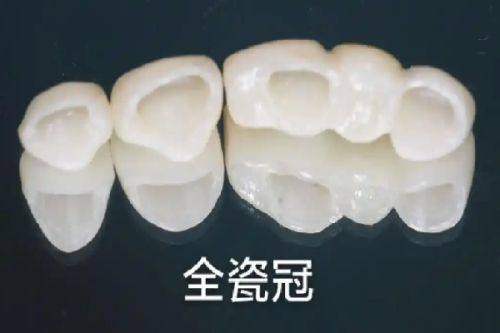 佳美口腔医院（保利大厦旗舰店）怎么样？真实患者分享就医体验！