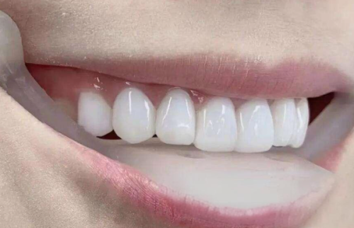 通州美新口腔门诊部怎么样？专业治疗与温馨服务让人放心！