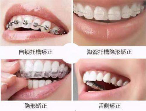 北京美尔目定慧医院怎么样？专业牙科服务与患者口碑分析！