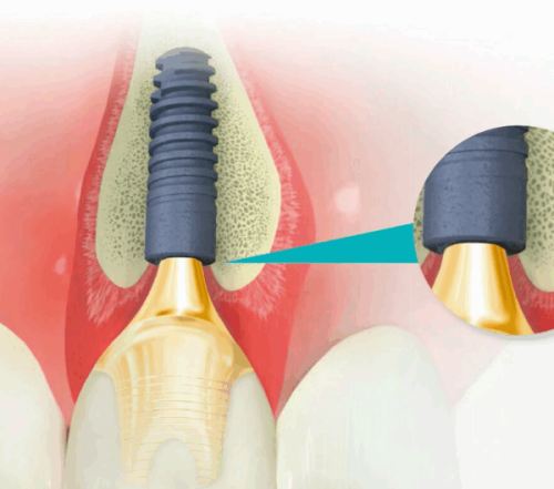 北京京一口腔门诊部怎么样？专业医生助您轻松解决牙齿问题！