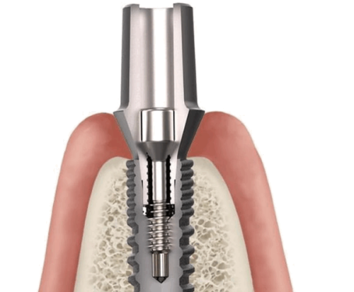 北京朝阳和风口腔怎么样？专业医师团队与先进设备让您安心就诊！