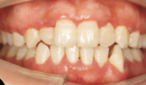 北京中鸿口腔门诊怎么样？专业医生与舒适环境让你安心就医！