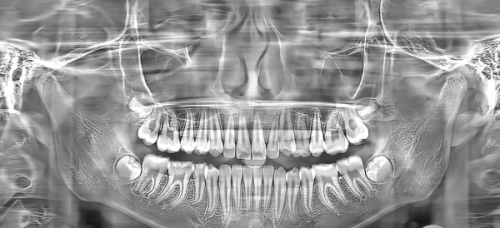 北京劲松口腔医院怎么样？专业医生与温馨服务值得信赖！