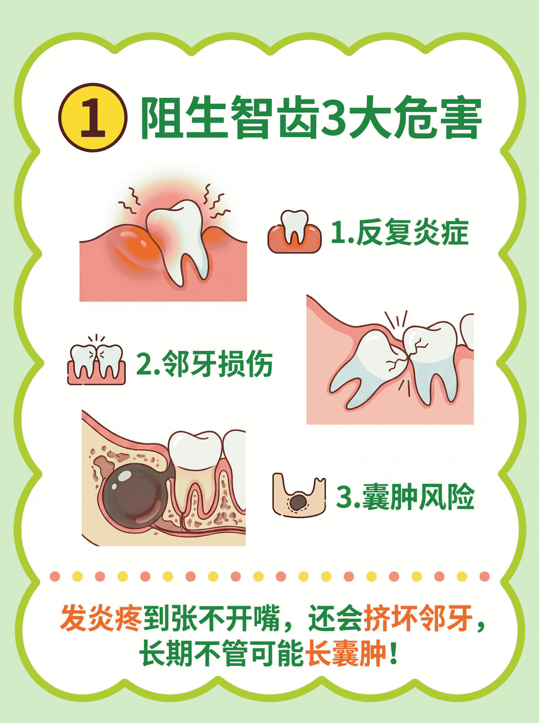 智齿疼到让人奔溃？这些情况需要尽早拔除！案例图片 2