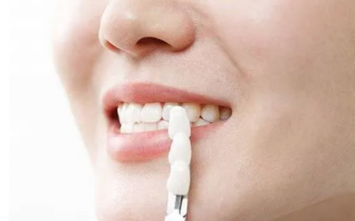 深圳诚美口腔门诊部怎么样？真实患者分享就医体验与效果分析