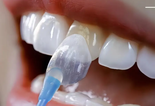 深圳元亨厚德口腔诊所(罗湖店)怎么样？真实患者分享治疗体验！