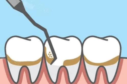 深圳泰乐口腔诊所怎么样？真实患者分享就医体验与效果分析
