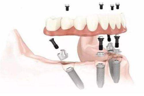 深圳格伦菲尔口腔医院龙岗区横岗店怎么样？专业医生与优质服务让你放心就诊！