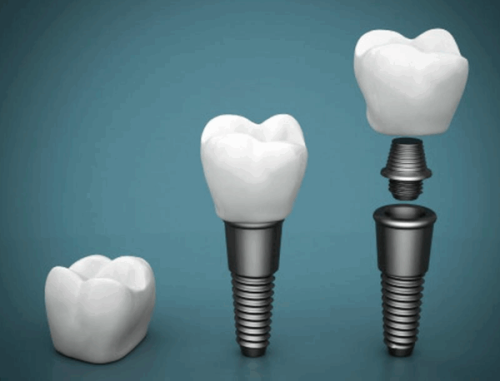 深圳元亨民健口腔诊所怎么样？专业服务与温馨环境深受患者喜爱！