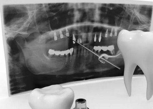 深圳格伦菲尔口腔（民治民丰店）怎么样？口碑好、服务优的牙科诊所推荐！