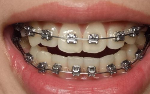 不同人群对深圳正恩口腔（罗湖总店）的评价