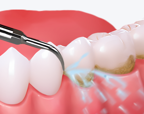 深圳梅奥口腔诊所怎么样？专业团队与优质服务值得信赖！