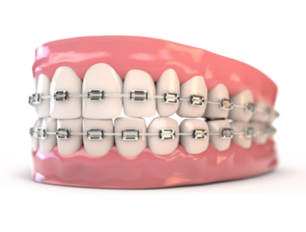 深圳驰正口腔(福田二店)怎么样？专业医生与优质服务让你放心就诊！