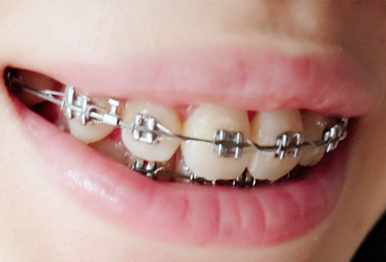 深圳华侨医院口腔科怎么样？专业医生与优质服务让你放心就诊！