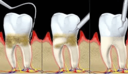 深圳麦芽口腔门诊部（龙华机构）怎么样？专业医生和优质服务值得信赖！