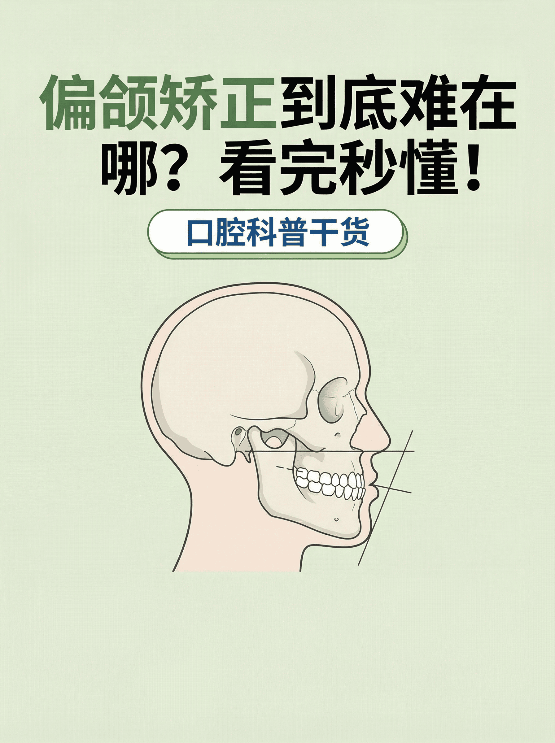 偏颌矫正到底难在哪？看完秒懂！