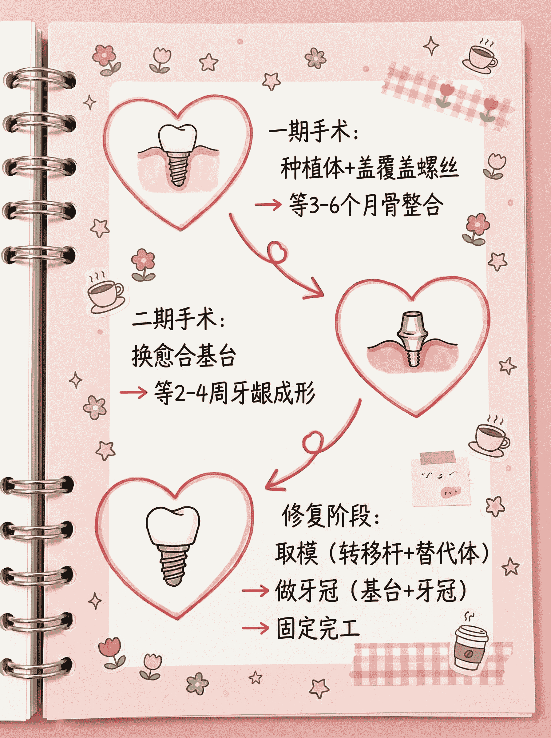 种植牙零件大揭秘｜7大核心部件全解析