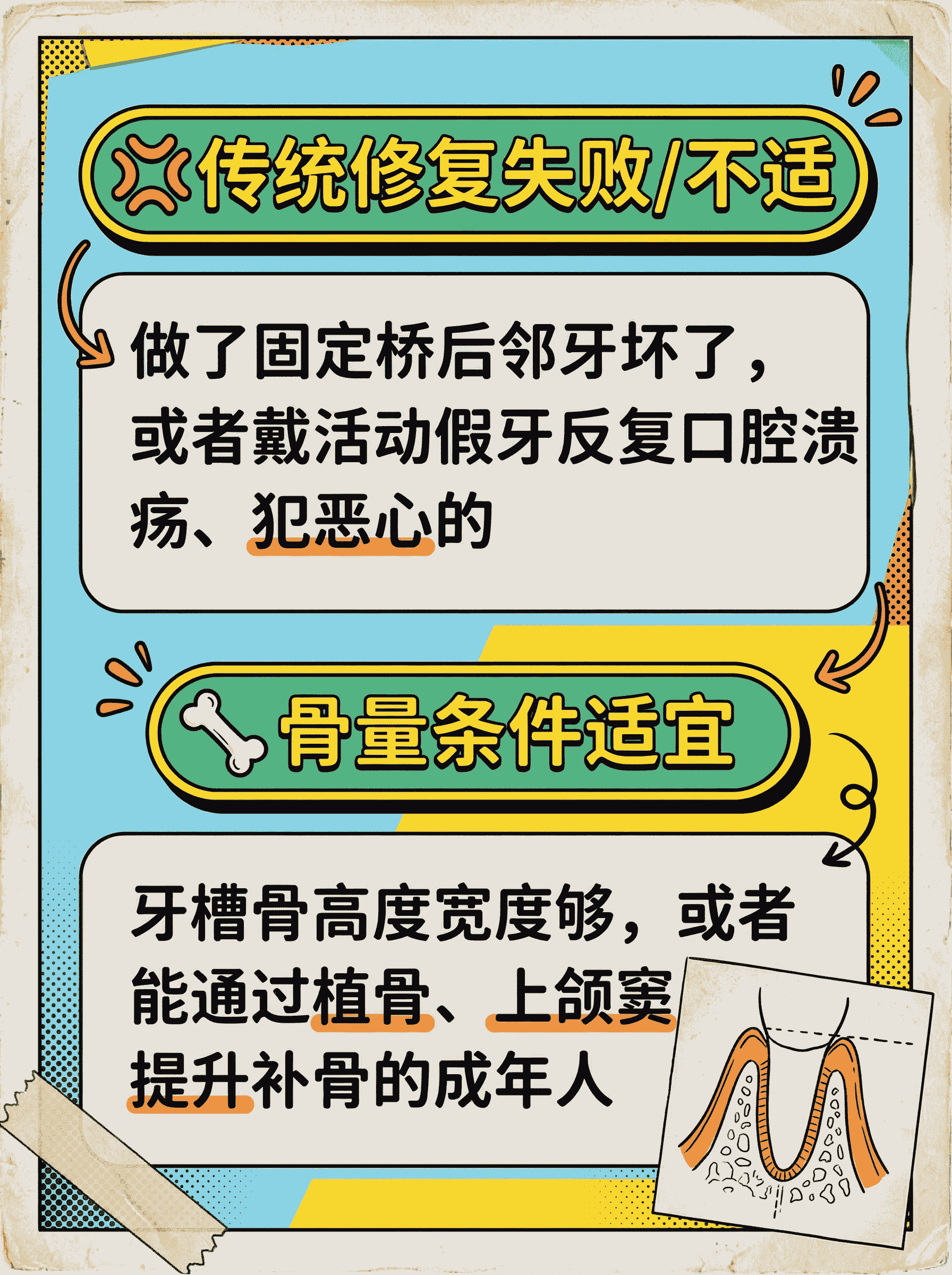 哪些情况适合种植牙？案例图片 3