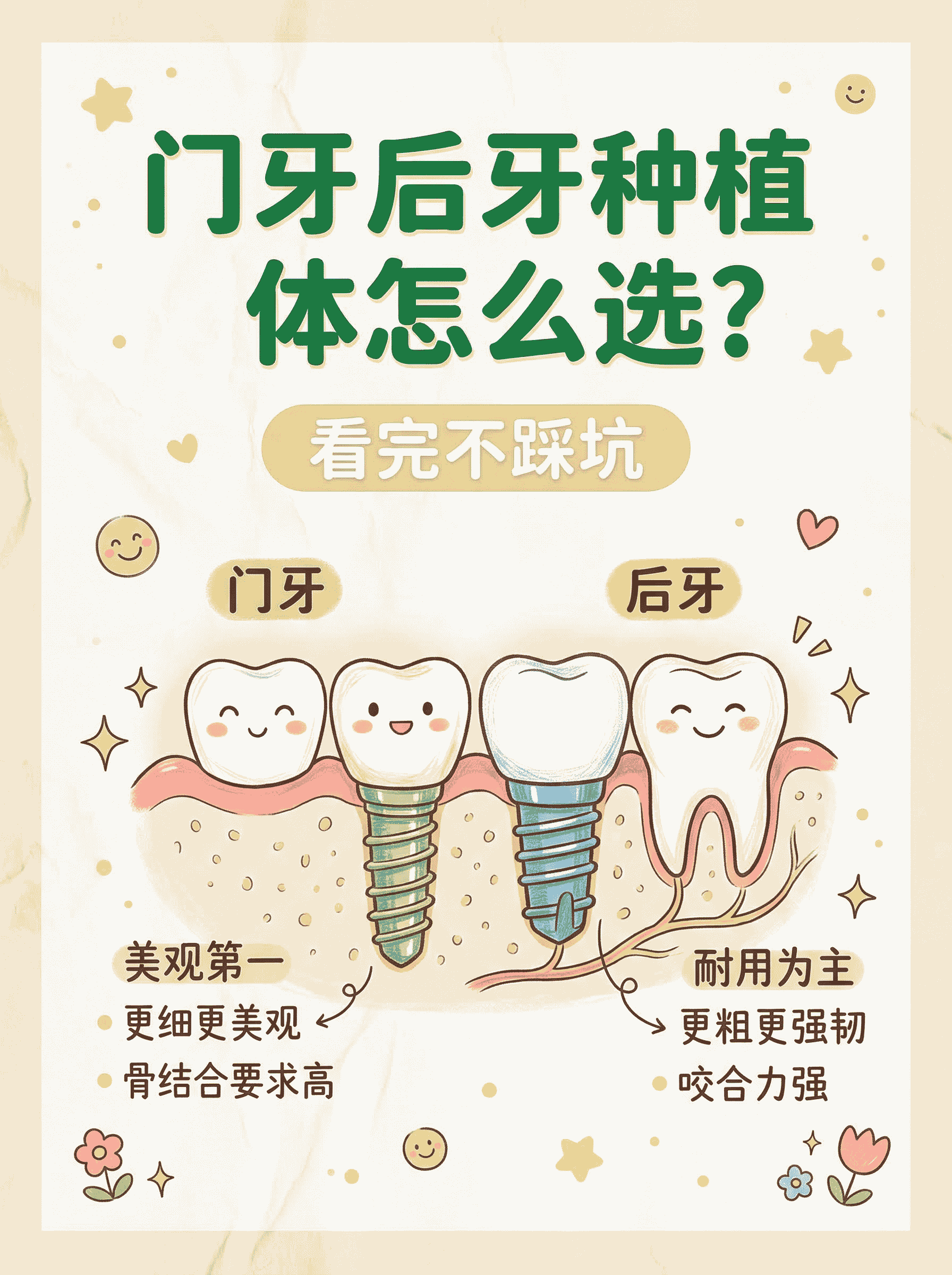 门牙后牙种植体怎么选？