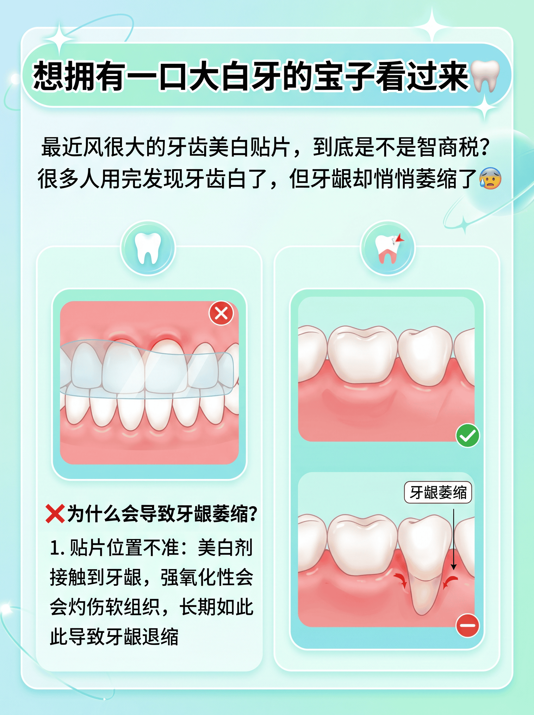牙齿美白贴片真香？牙龈萎缩警告⚠️案例图片 3