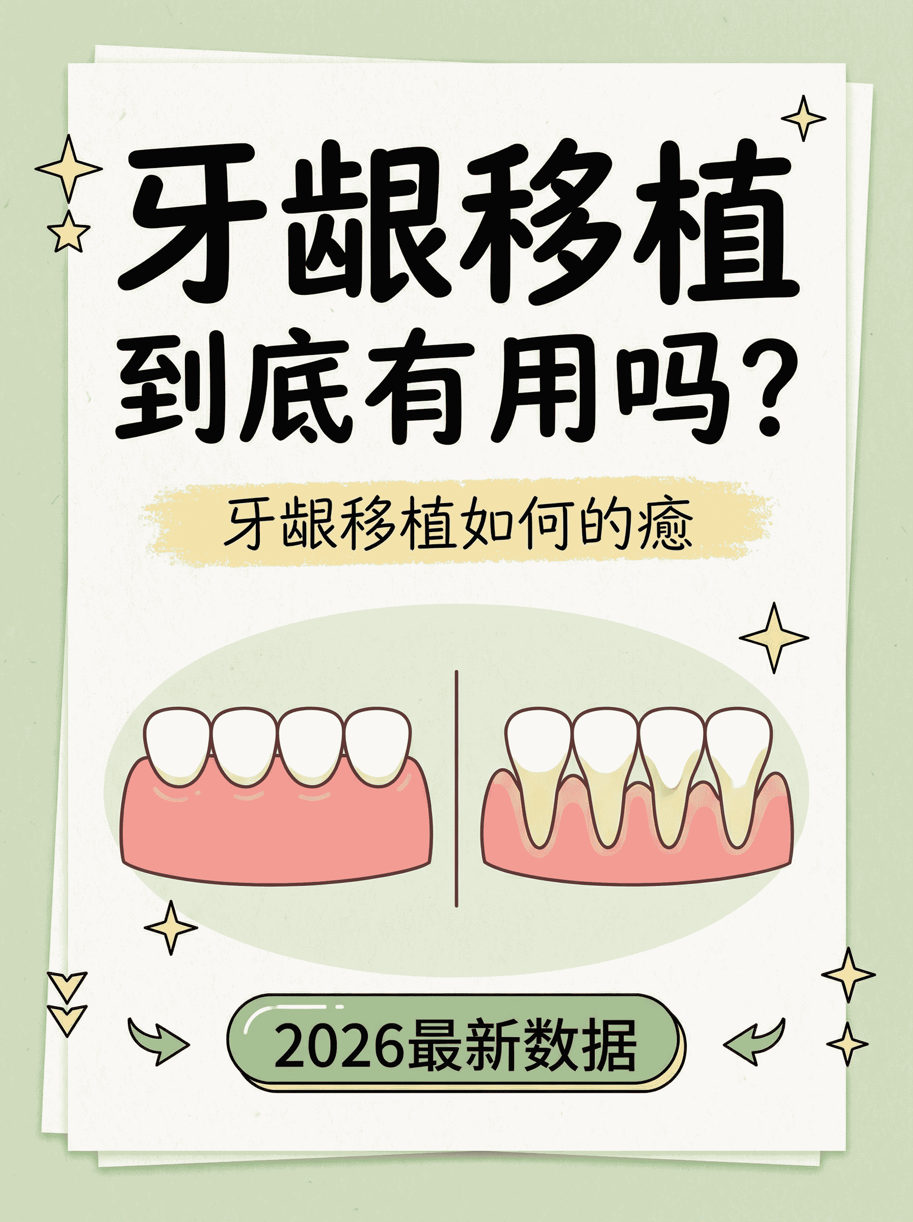 牙龈移植手术到底有用吗