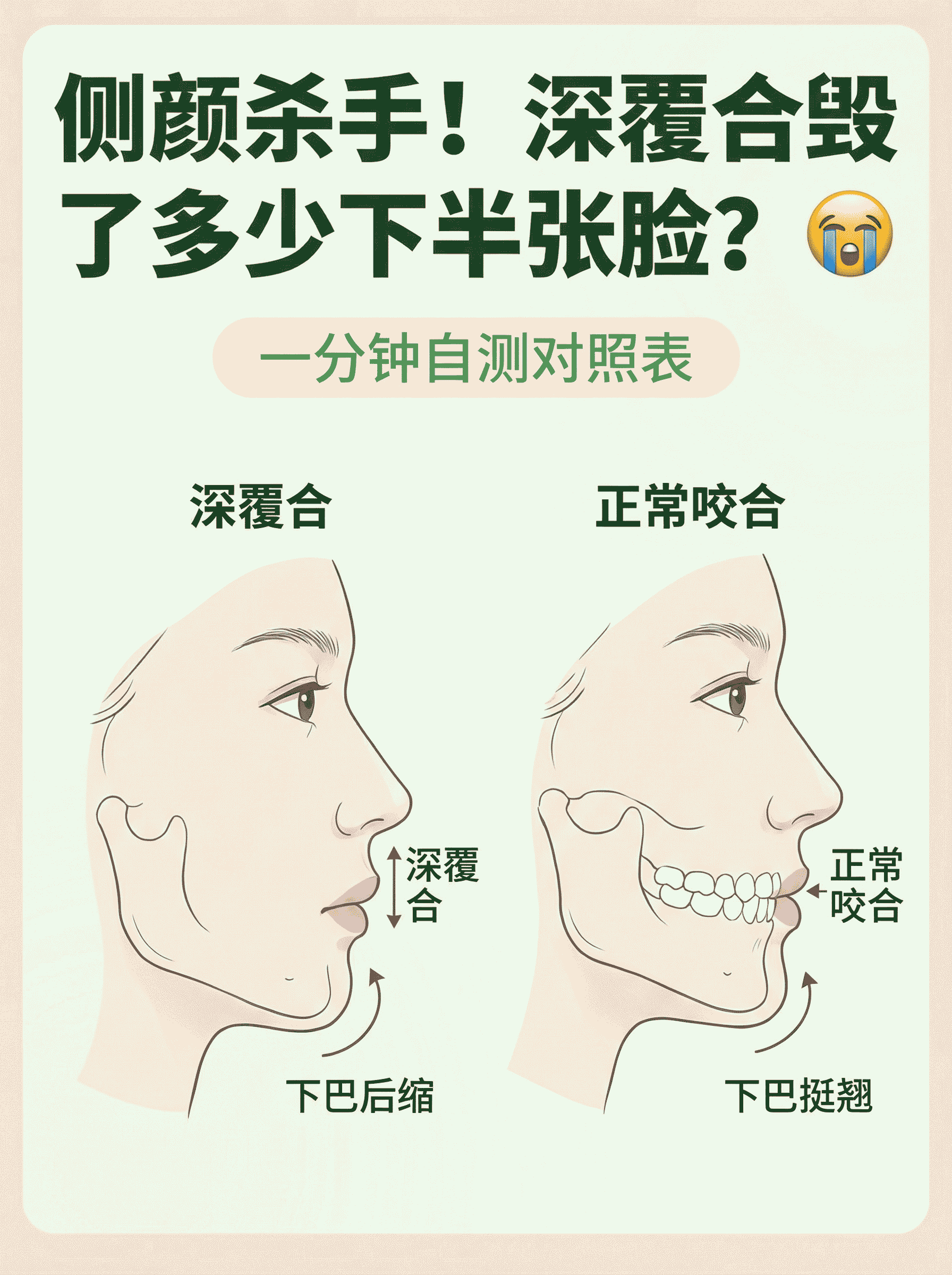 侧颜杀手！深覆合毁了多少下半张脸？😭
