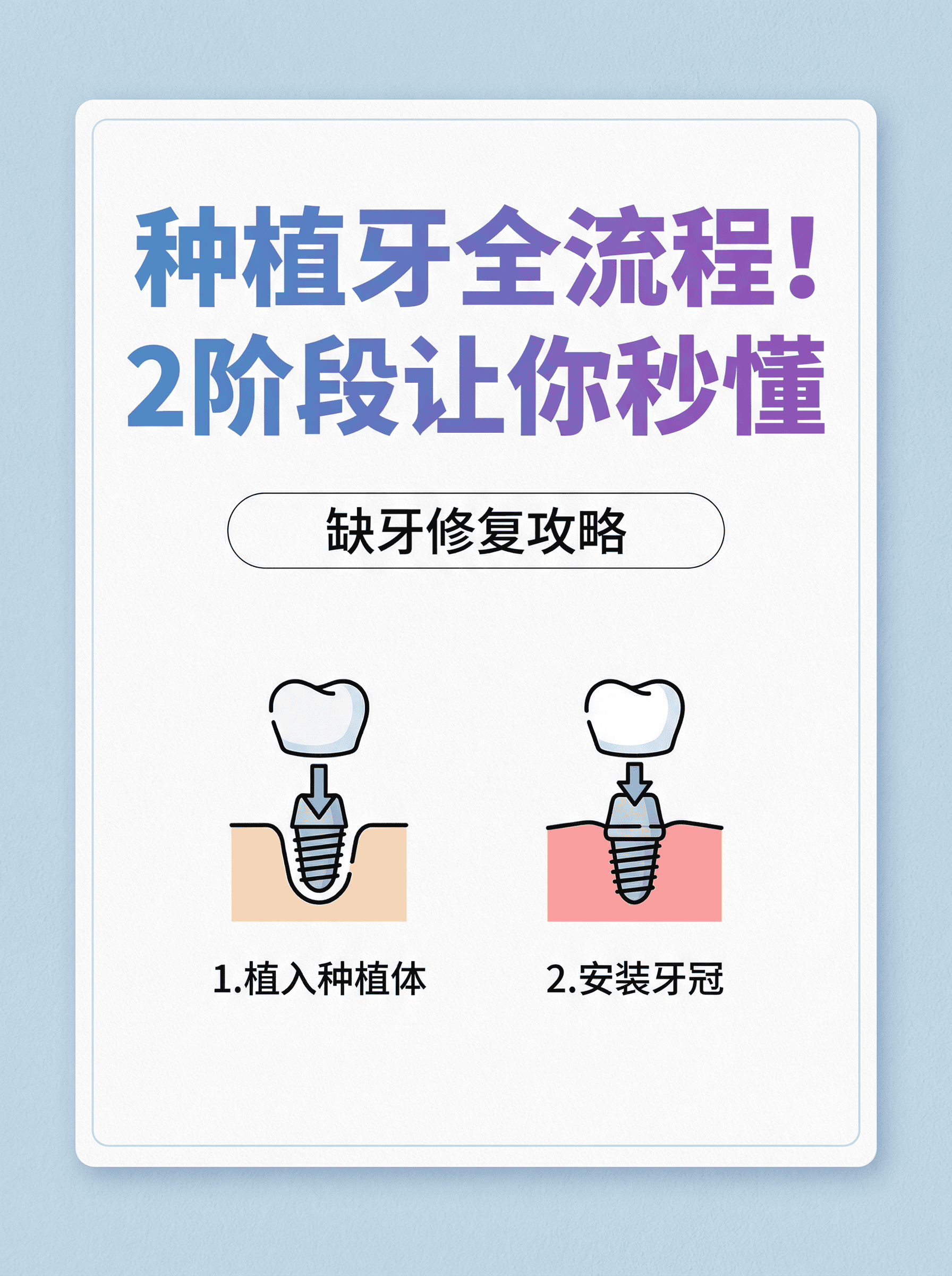 种植牙全流程！2阶段让你秒懂