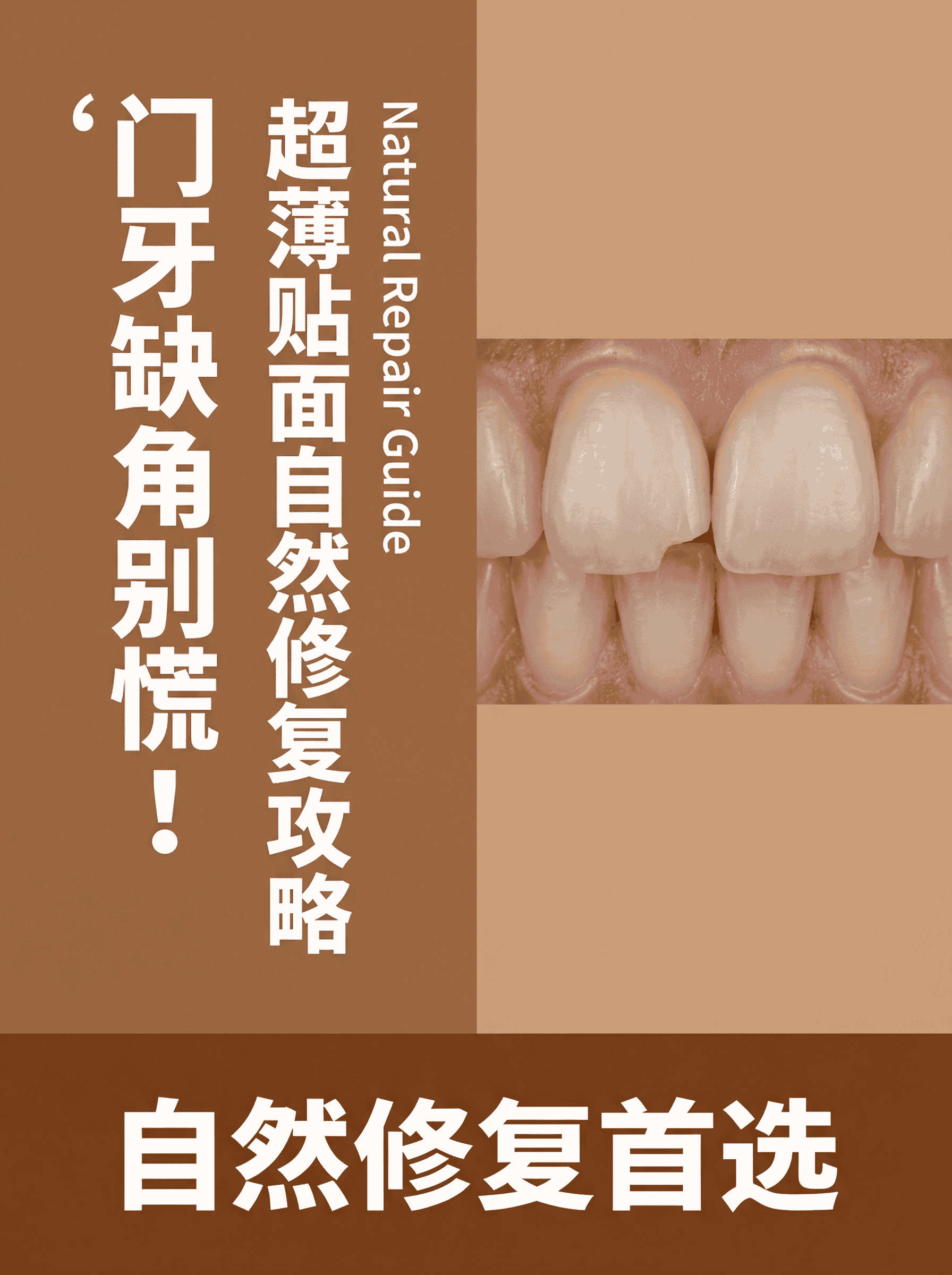 门牙磕掉一小块怎么修复最自然