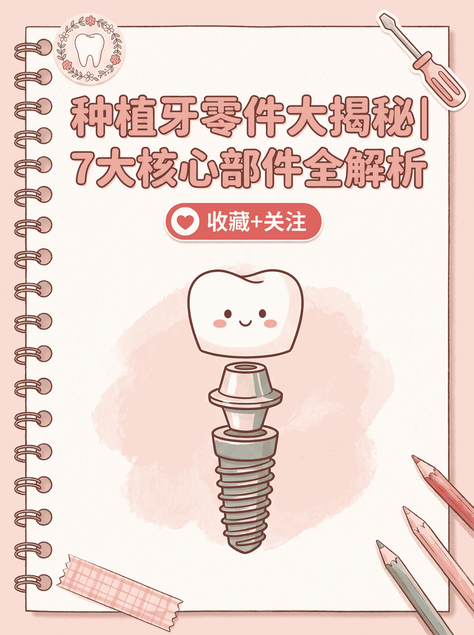 关于种植牙过程中，需要用到哪些材料零件？