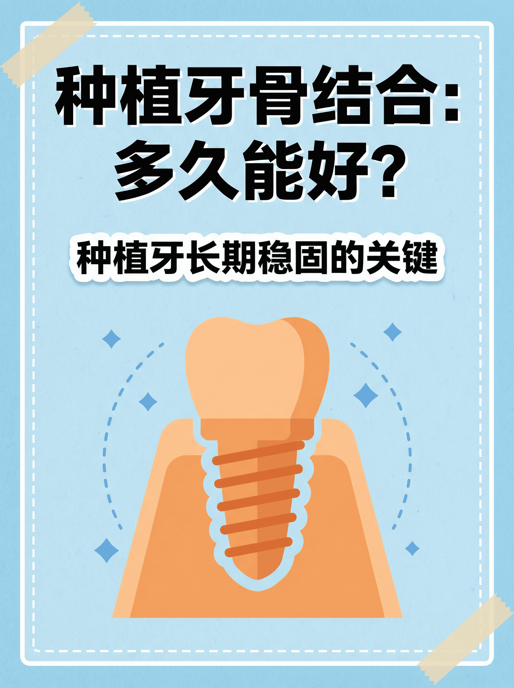 种植牙骨结合：多久能好？