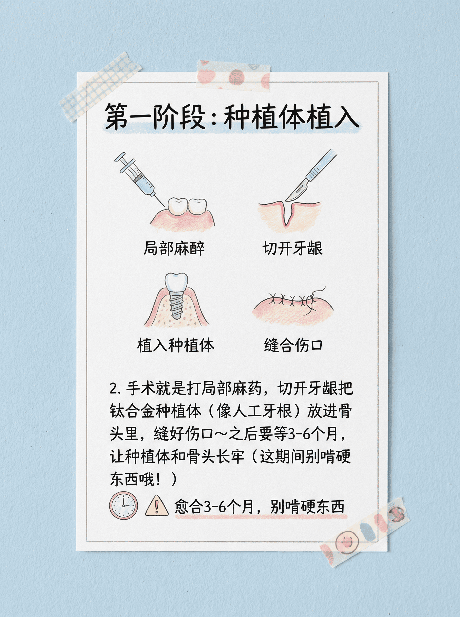 种植牙全流程！2阶段让你秒懂案例图片 3