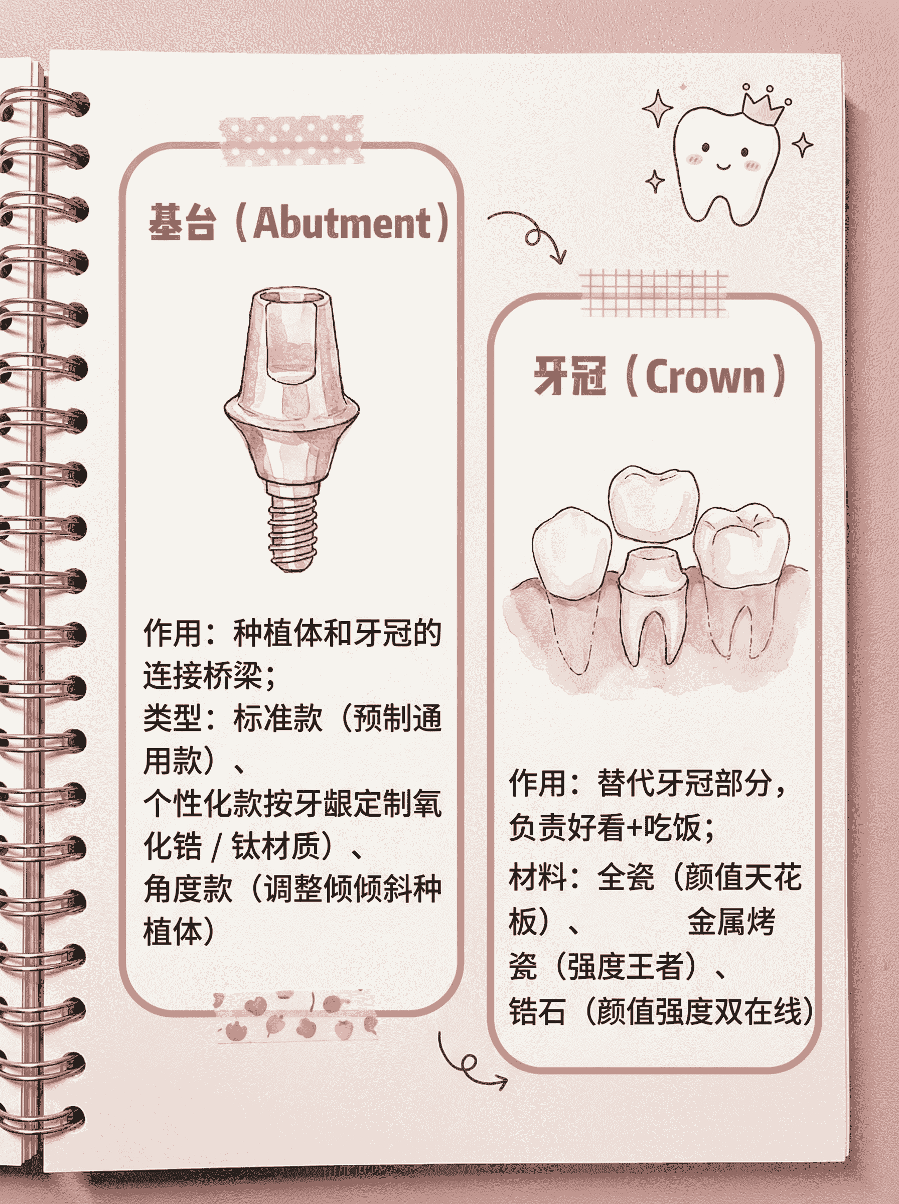 关于种植牙过程中，需要用到哪些材料零件？案例图片 3