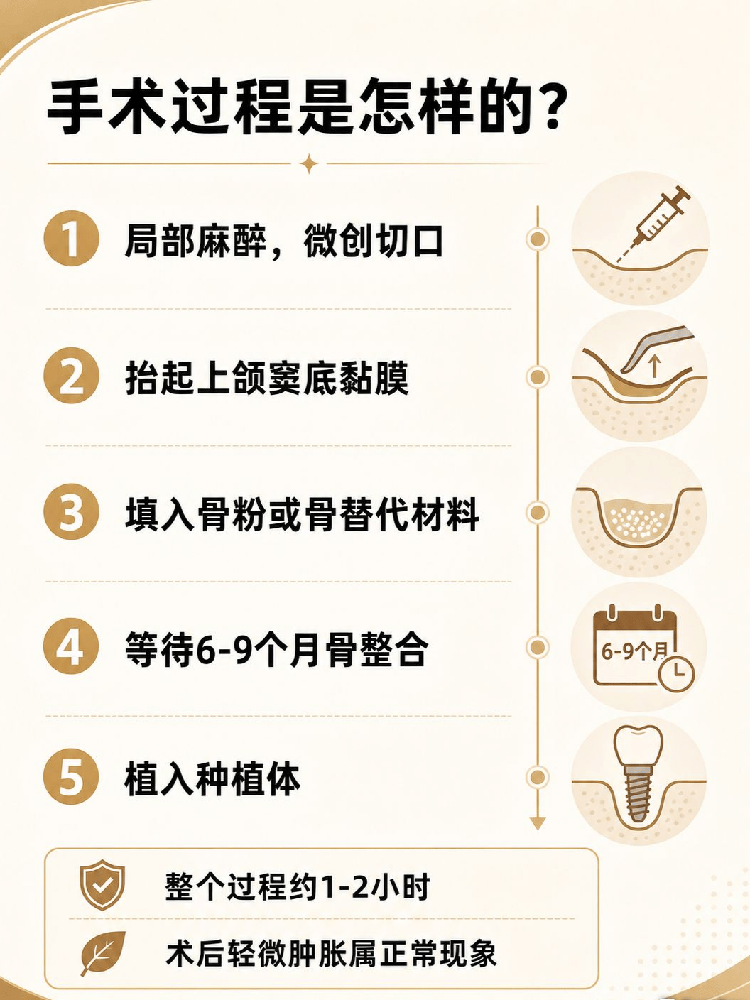 上颌窦提升到底是什么？种牙人必看懂案例图片 3