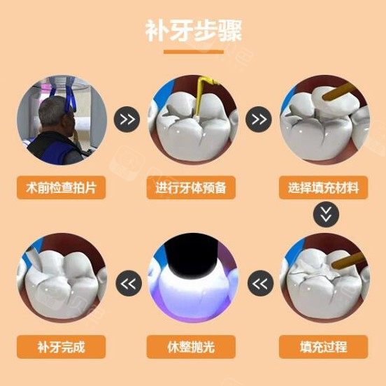 【补牙树脂美学修复】仅售160元,价值260元成人树脂补牙,节假日通用