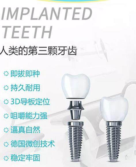 首页>  商品列表 >  详细页面韩国进口登腾dentium种植牙:原价4480元