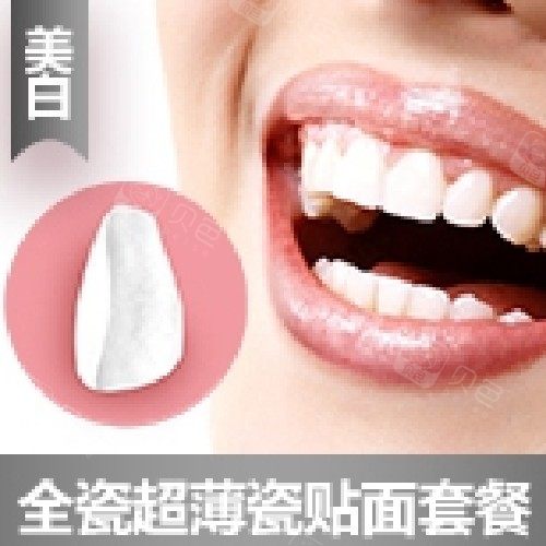 【牙齿贴片全瓷贴面】全瓷瓷贴面