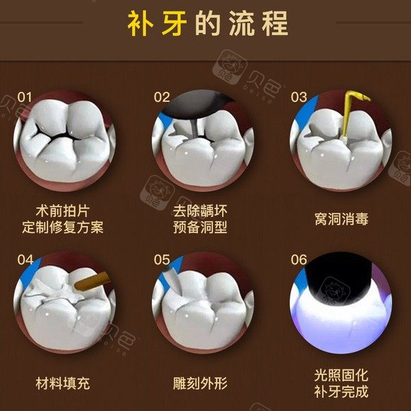 树脂补牙能用多久,效果图,材料(第6页)_大山谷图库