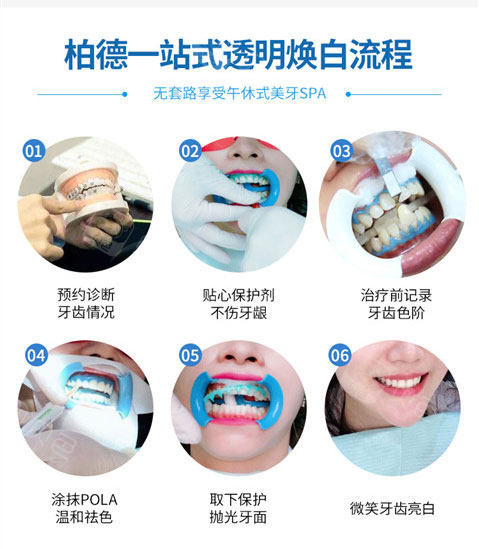 【牙齿美白日本pola臻白亮齿】澳洲pola牙齿美白套餐