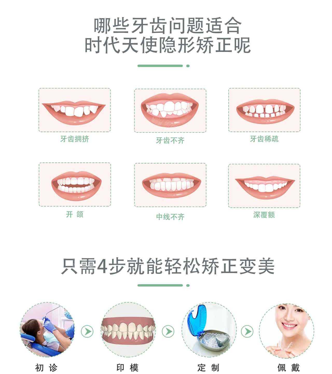 【隐形矫正时代天使】时代天使隐形矫正(comfos青春版)